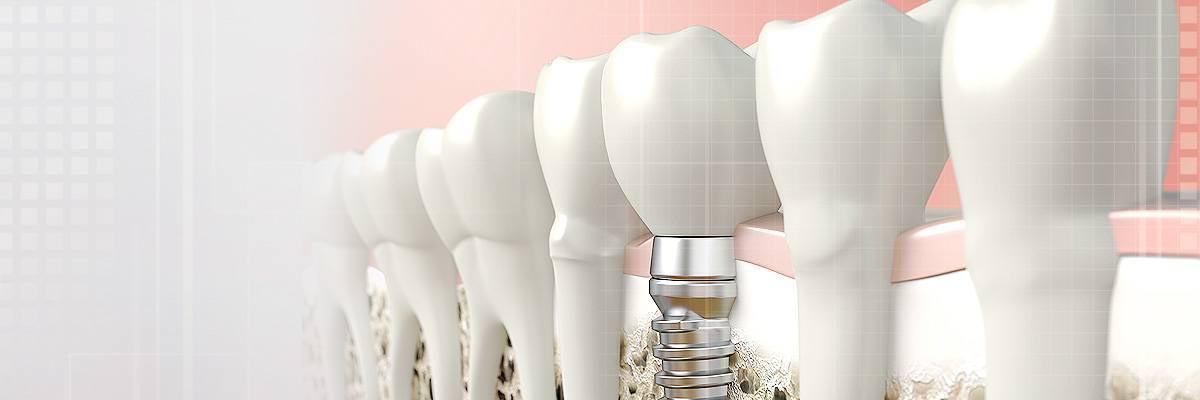 Tucson Dental Prosthetics