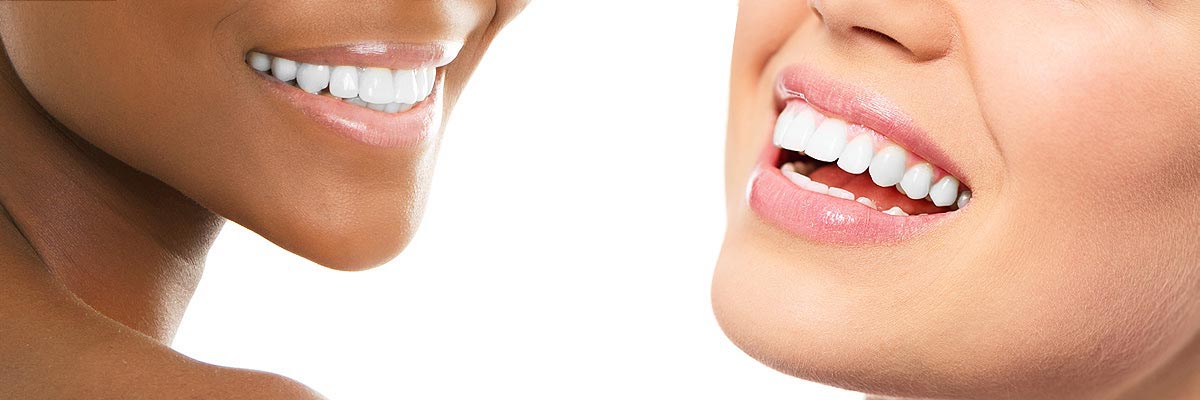 Tucson Teeth Whitening